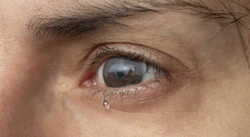 Dry Eyes